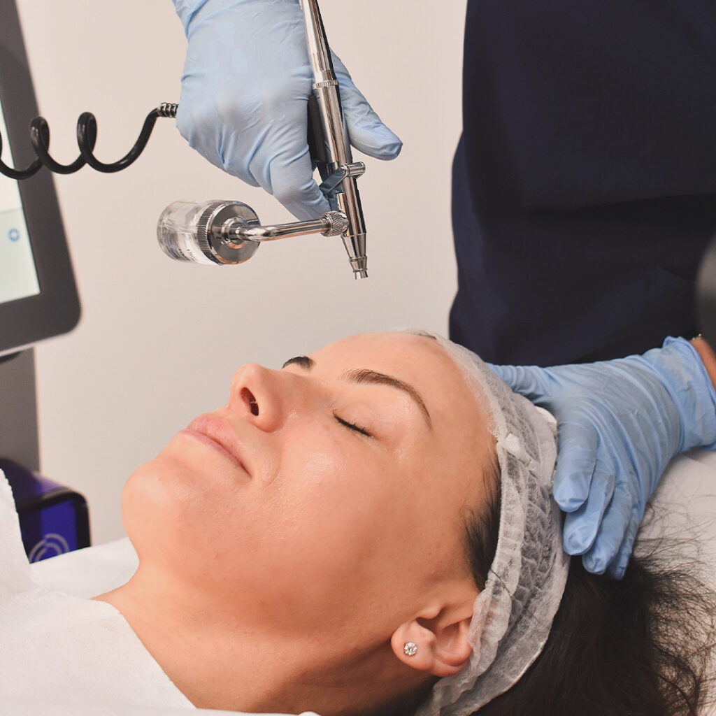 Hydrafacial Treatment